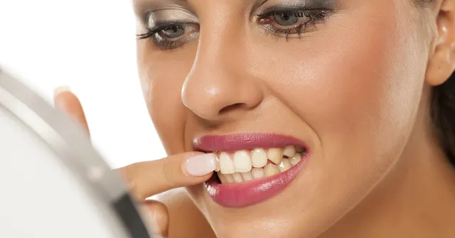 How to Identify and Manage Black Triangles in Aesthetic Dentistry