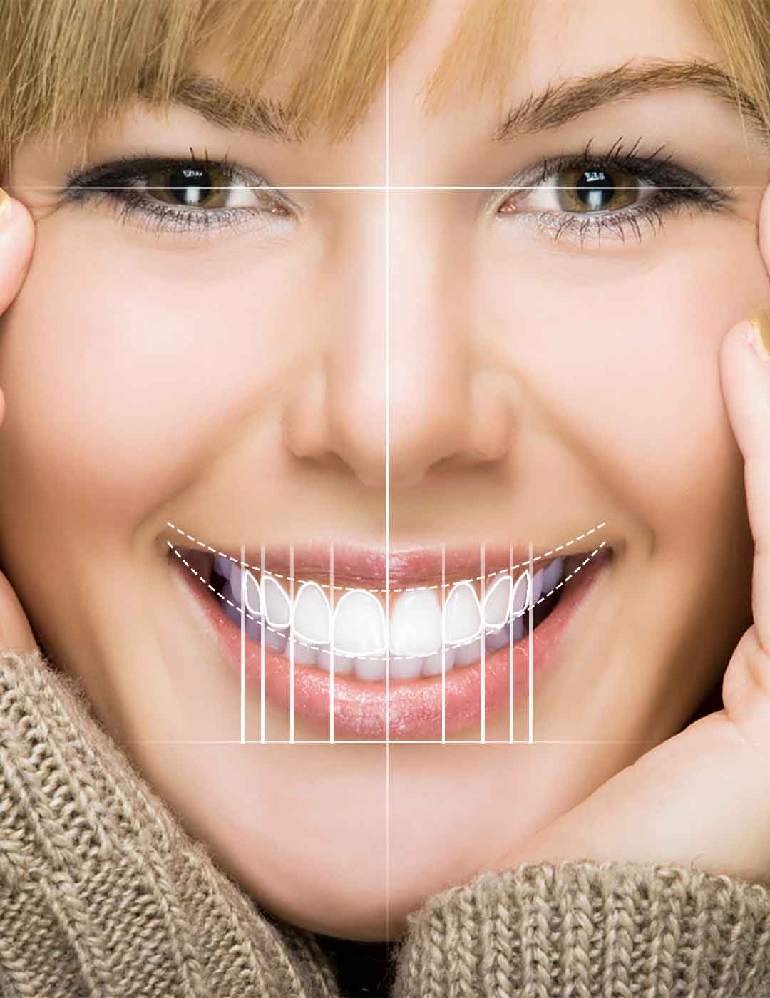 Digital Smile Design: How Technology is Creating the Perfect Smile