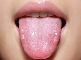 How Dentists Diagnose and Treat Burning Mouth Syndrome