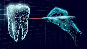 Understanding the Role of Lasers in Managing Gingival Pigmentation